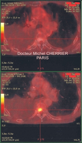 COUPE SAGITALE AU NIVEAU DE LA 6° VERTEBRE DORSALE - Clinique du mal au dos